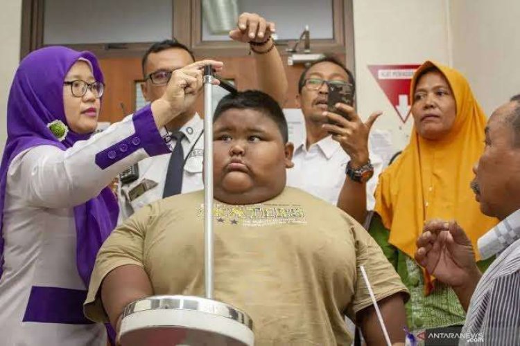 Guru Besar UI: Malnutrisi Anak-anak Indonesia Makin Mengkhawatirkan